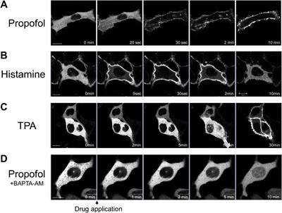 Features and mechanisms of propofol-induced protein kinase C (PKC) translocation and activation in living cells